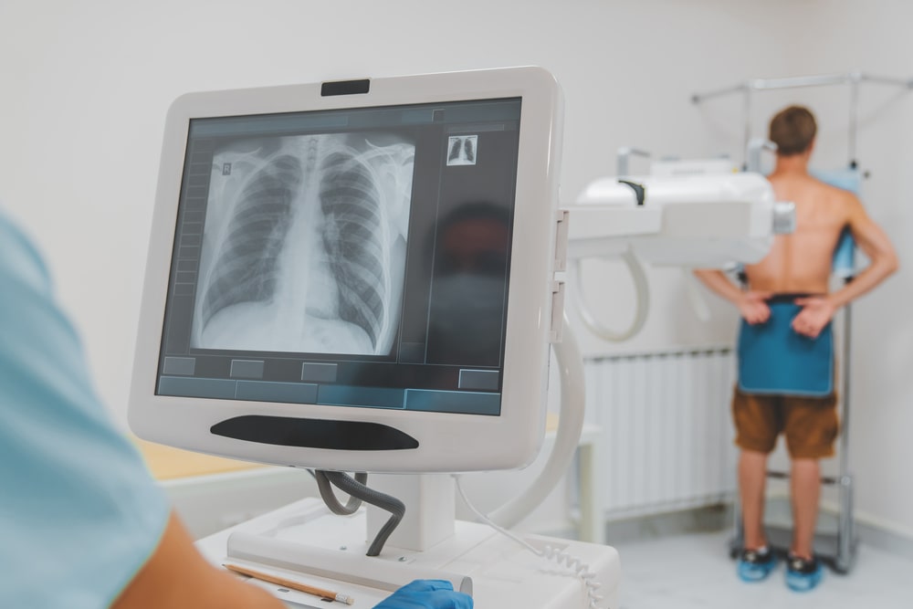 X-Rays